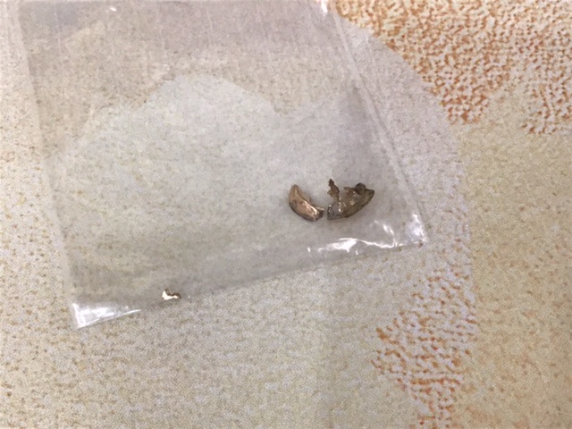 金歯 をお買取致しました。