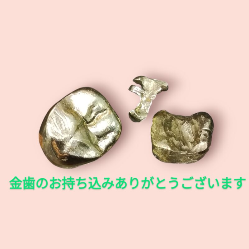 金歯 お買取しました。