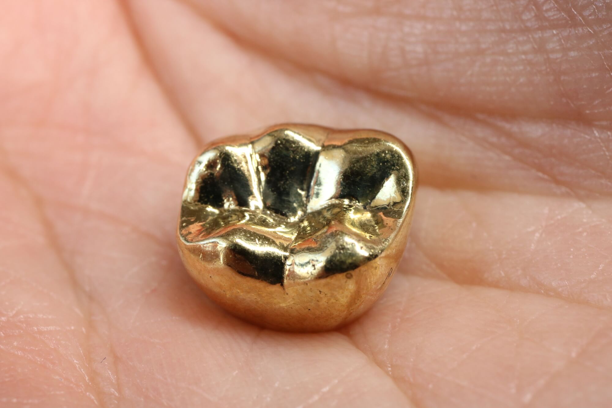 金歯は買取可能？専門家が査定の仕組みと相場、高く売るための全知識を